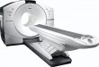Now the method of cancer treatment will change: 'Discovery IQ Gen2' PET CT scan machine started in Maringo CIMS Hospital